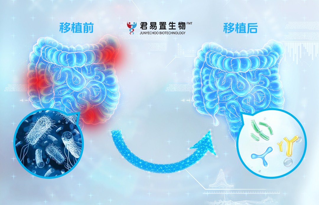 腸道菌群移植